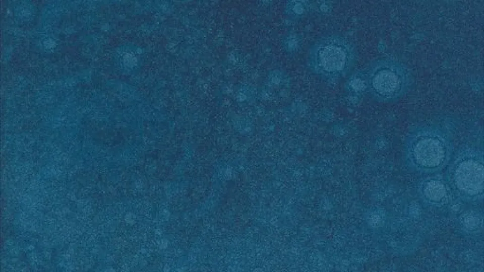 Ohenneruiskutus RAL 865-M